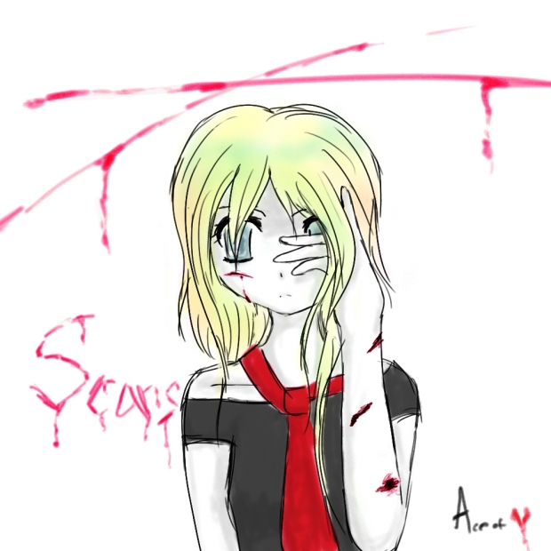 My Scars